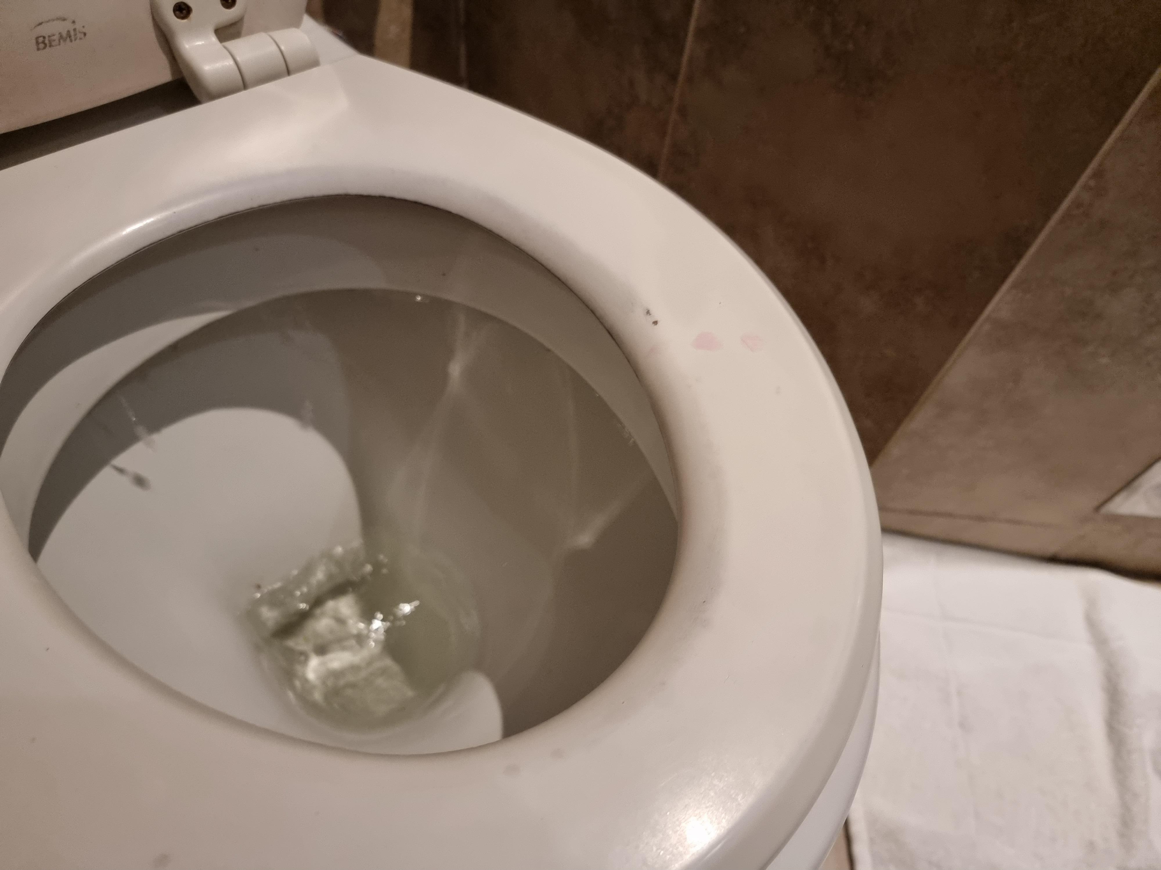 Cracked and stained toilet seat