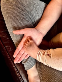 Crawling baby's foot AFTER we cleaned- much worse before. :[