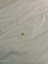 Stain on the sheet.