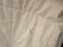 Stain
