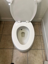Dirty toilet, poop stained