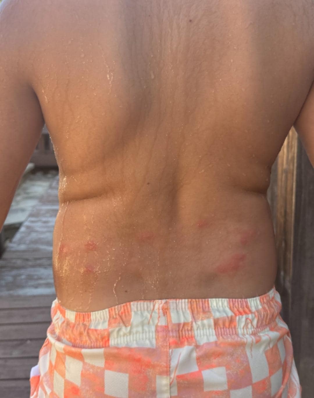 These are the bite marks my 9 year old grandson had the day after we left this place.