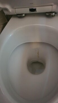 Loose toilet seat