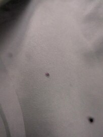 Bed bug
not cool