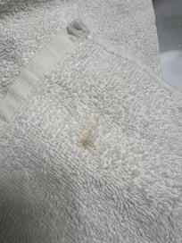 Stains on towels