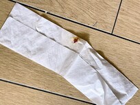 Bloody tissue on the floor