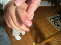 My daughter’s cut finger after moving positions on the loveseat and cut on chards of glass that was stuck in the fabric of the couch.
