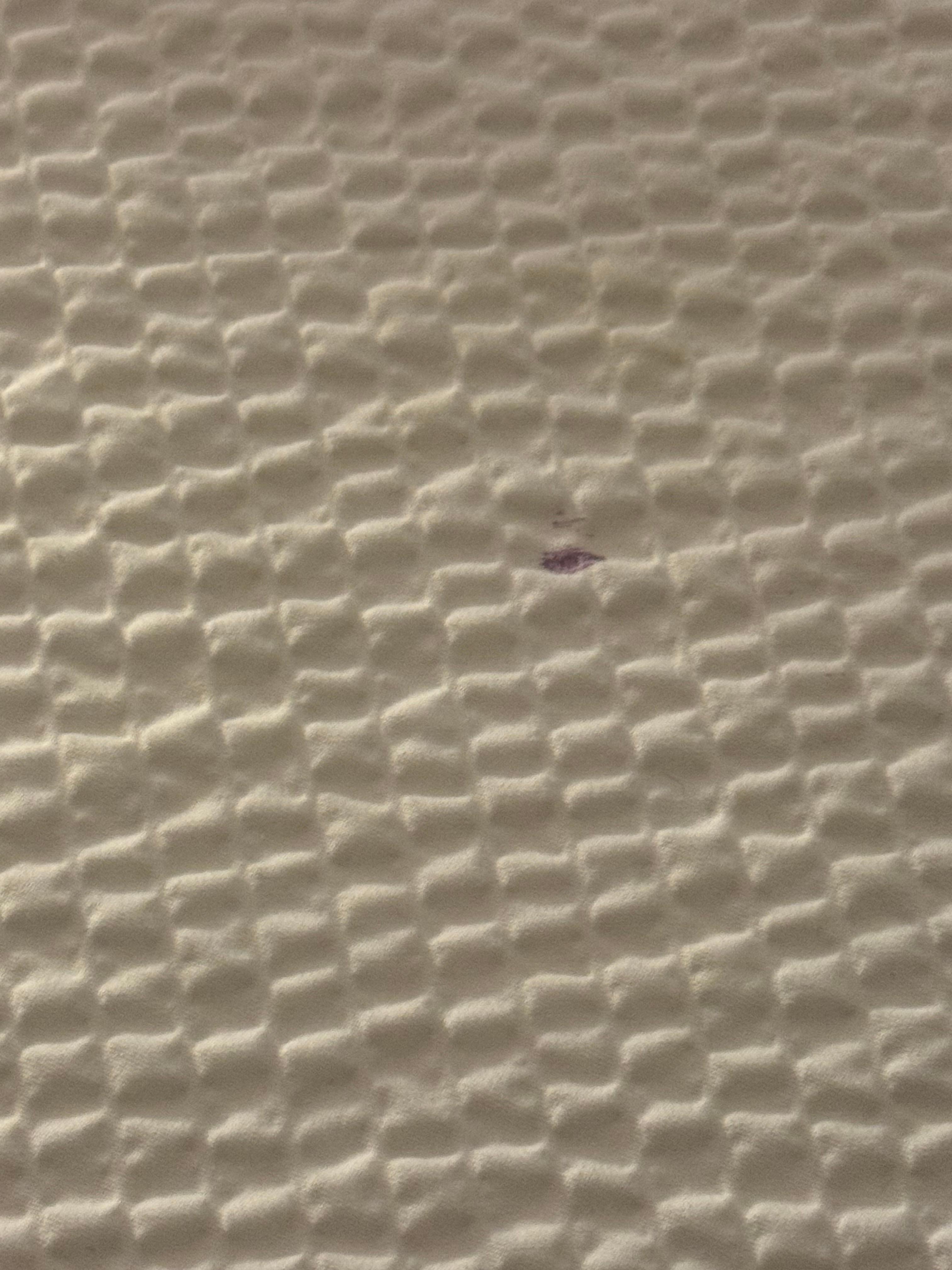 Blood spots on bed