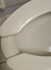 This is the residual hair and gunk after my spouse had already tried to flush it away (when we thought we were just going to tough it out)