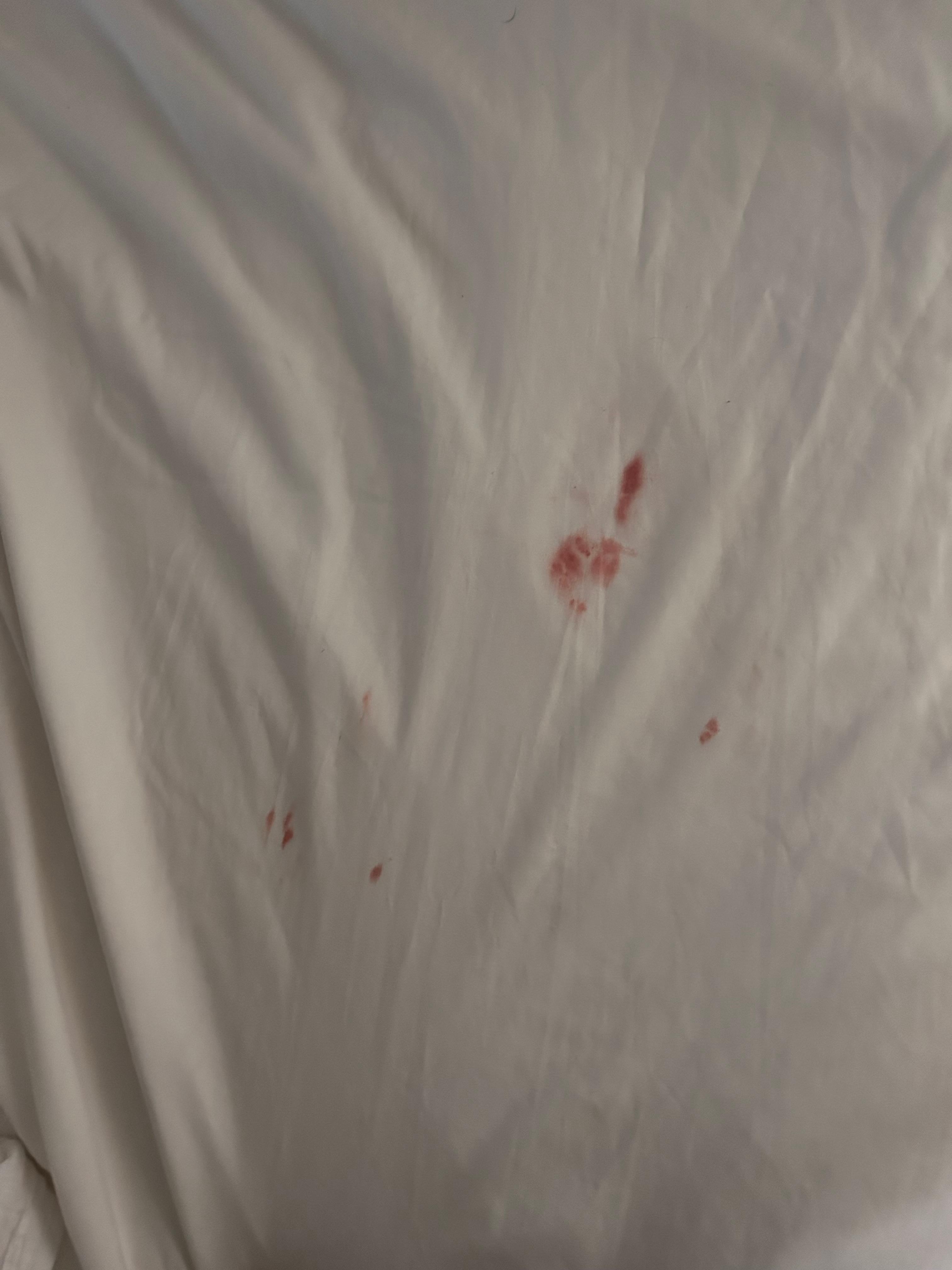 Blood on sheets 