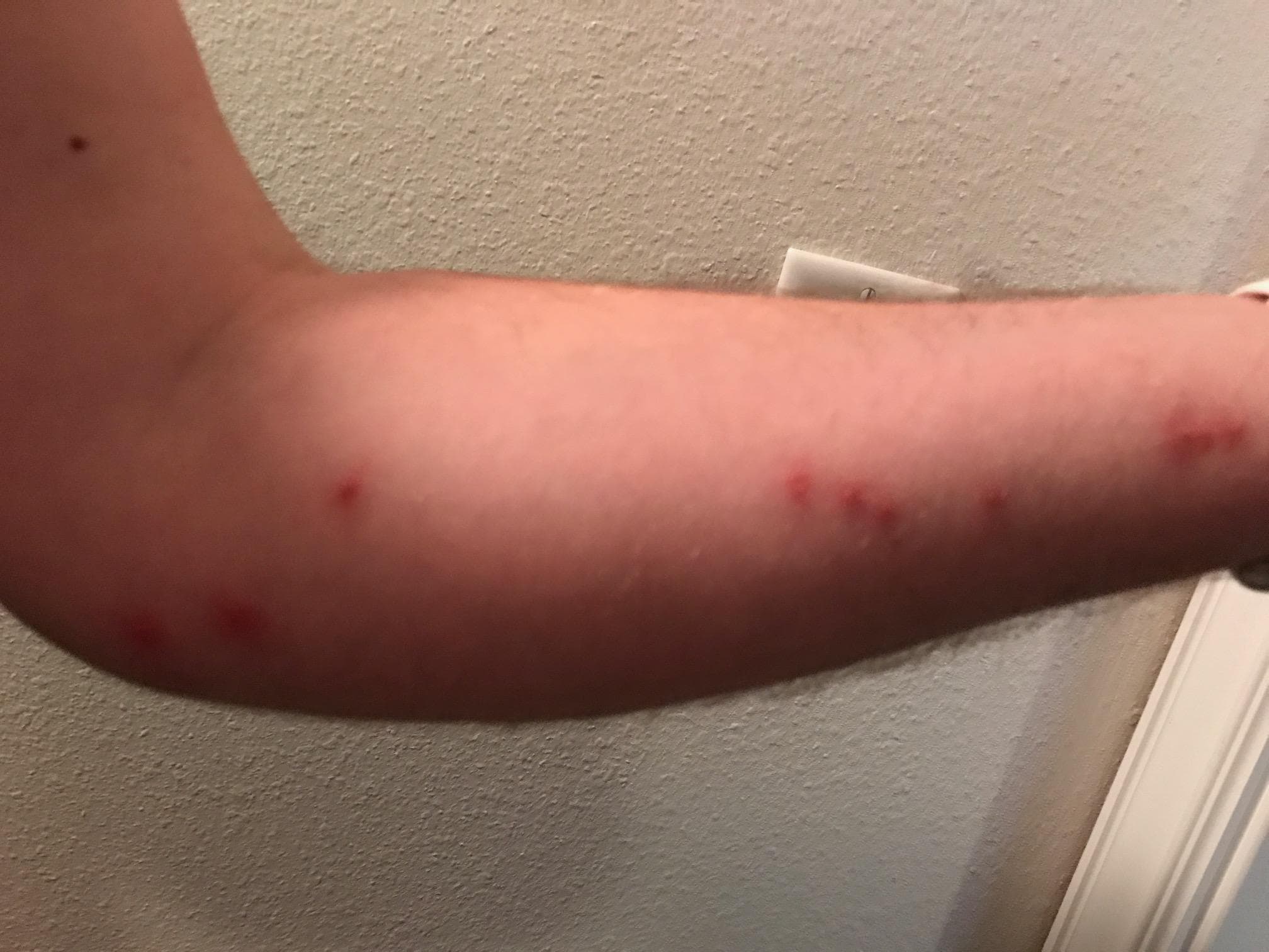 Bed Bugs a week later