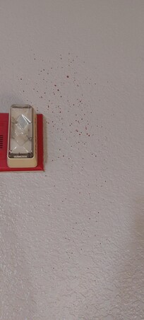 Literally BLOOD splayed on the wall!!