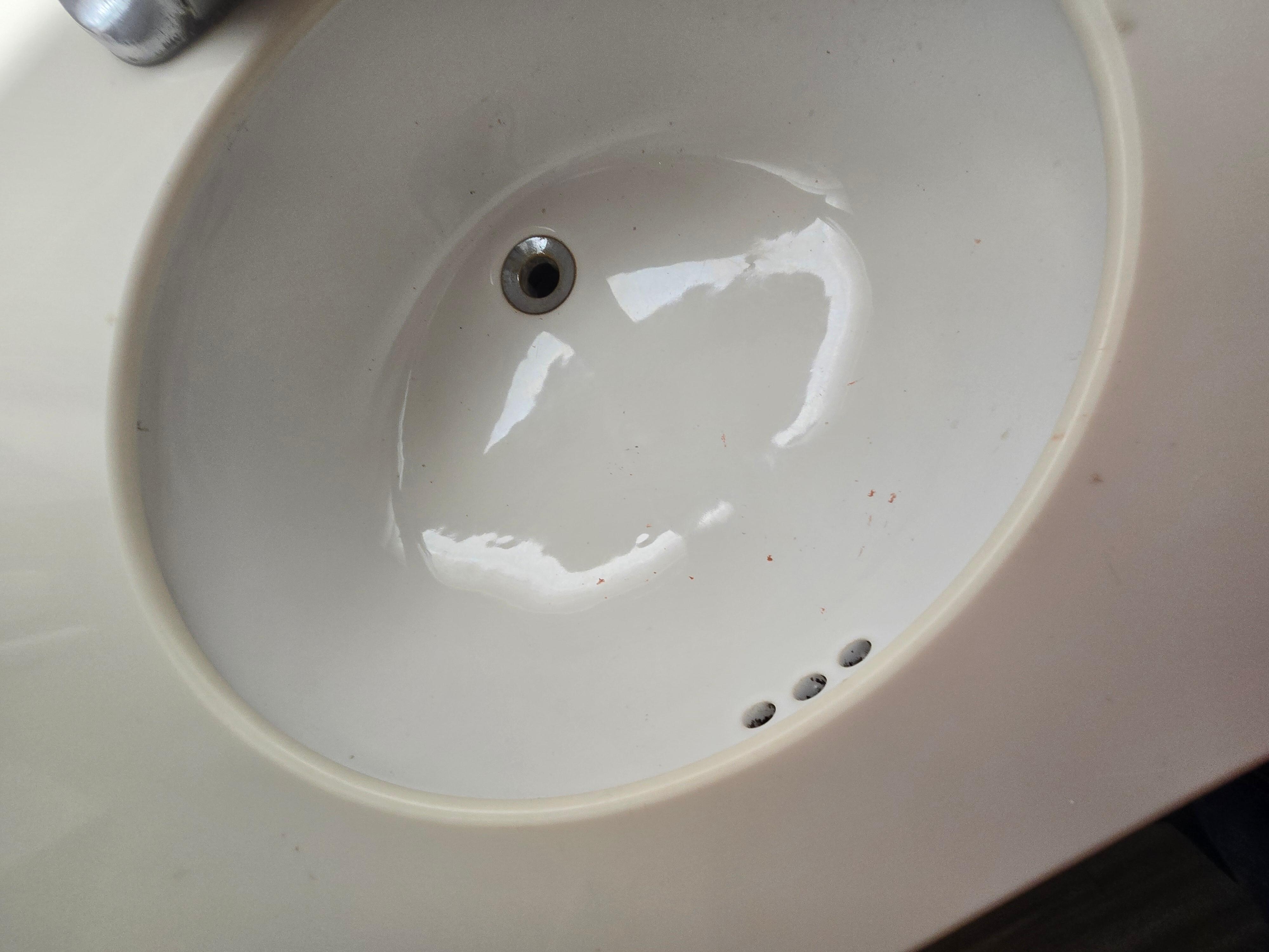 Blood in the sink
