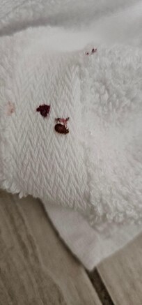 Bed bug on towel