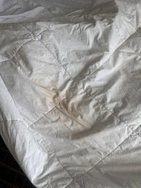 Así estaba el edredón por lado dentro asqueroso