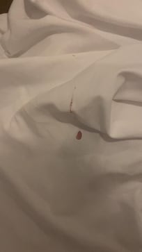 Blood stain on bed sheet