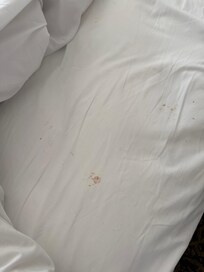 Blood on sheet
