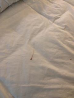 Lovely blood smear