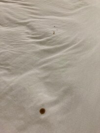 Spots on sheets.