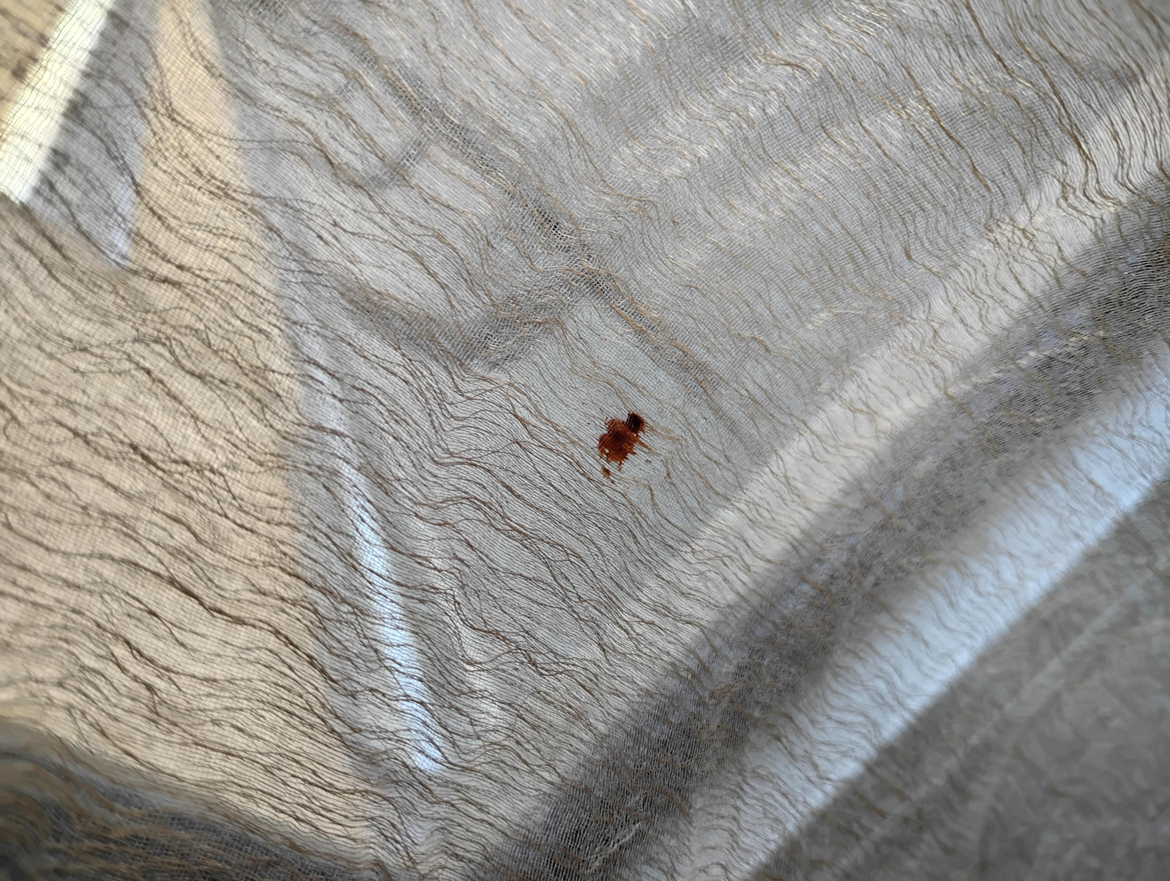 Blood on the curtains ??
