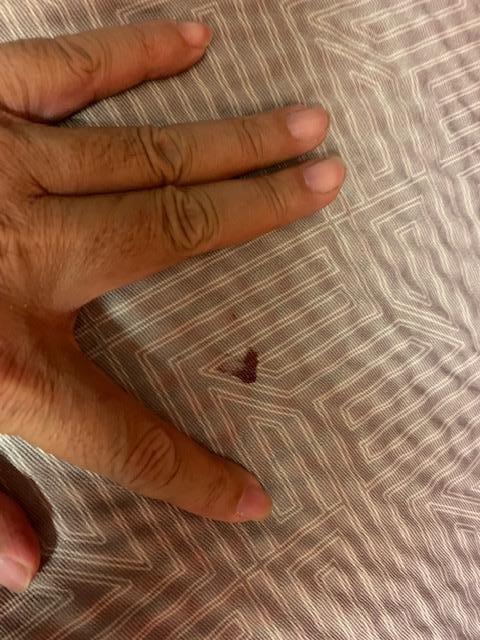 blood stain on bedspread
