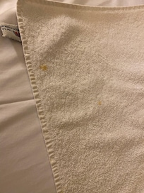 Taches sur les serviettes