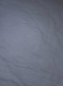 Hairs all over all the beds