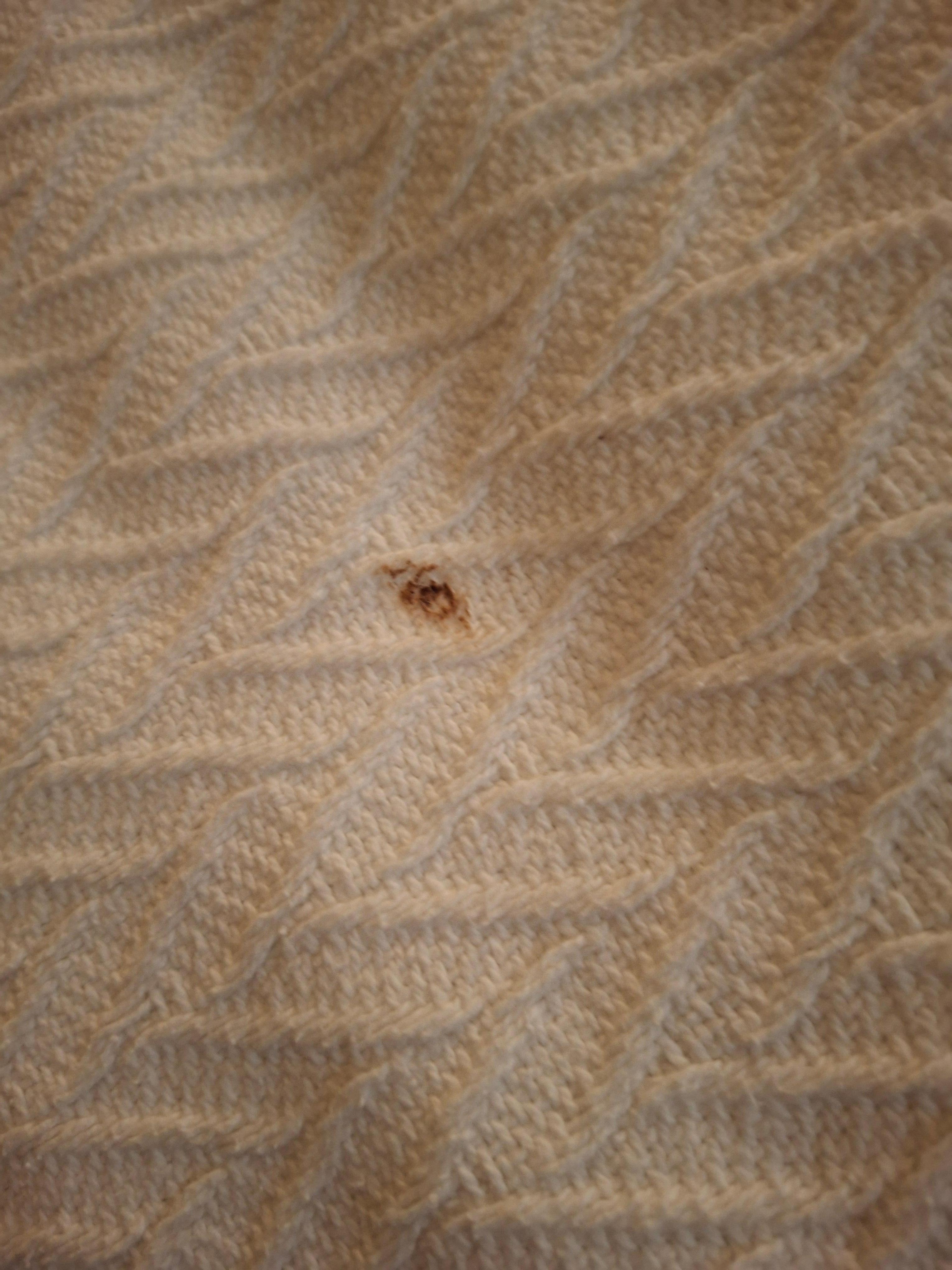 Stain on bedding