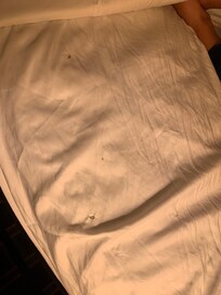 Cigarette burns in sheets