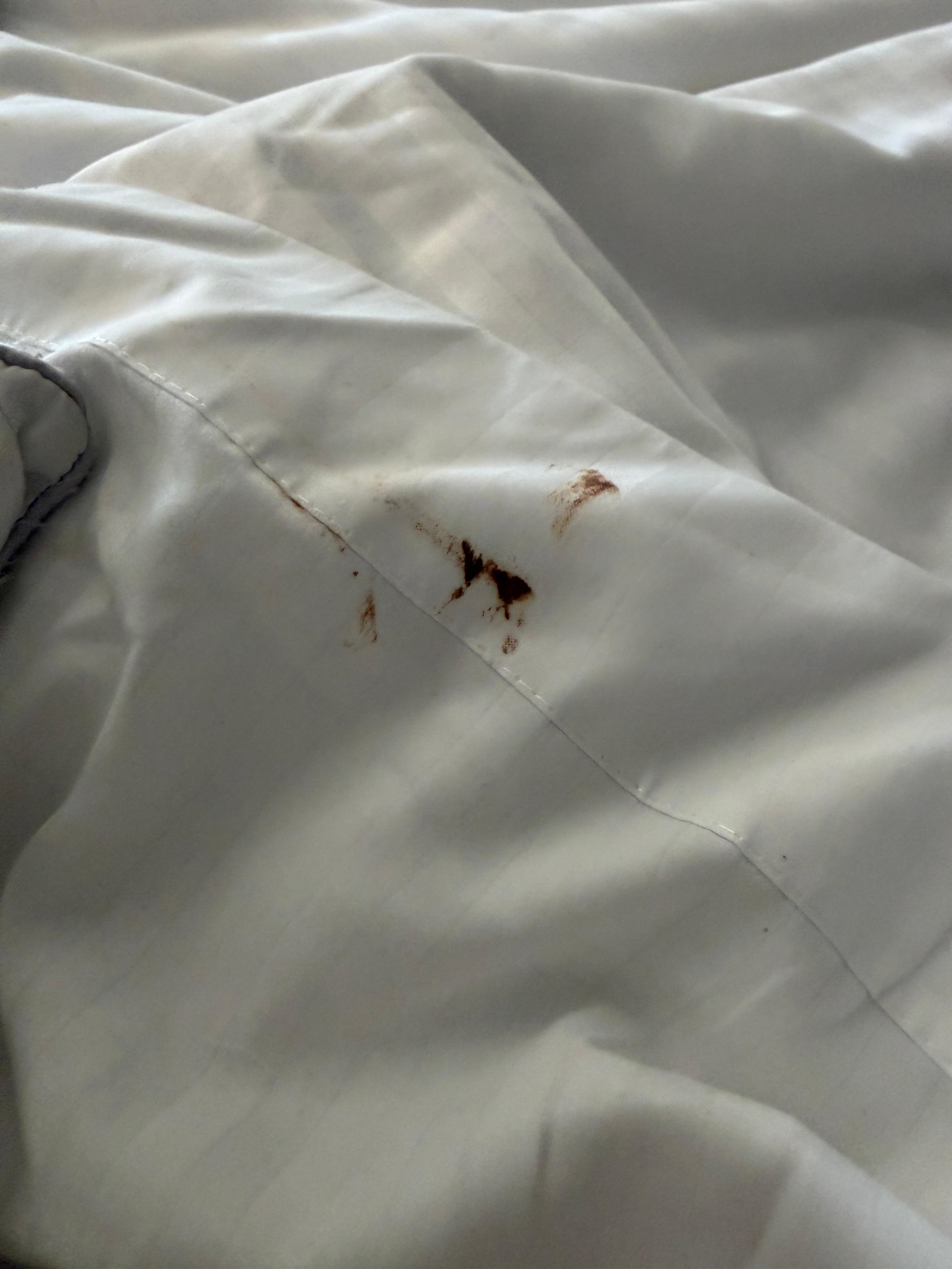 Stain found on sheet. 