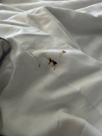 Stain found on sheet.