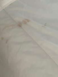 stains on the blanket and bed looks like blood