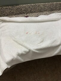 Blood on clean towel