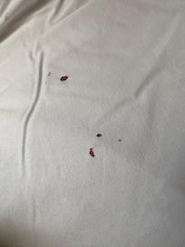 Dried blood stains on the sheets