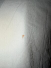 Blood on pillow