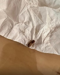 Sembra strano, ma devo dire grazie a questo scarafaggio, per farmi cambiare di stanza, ho avuto una crisi di rinite allergica appena entrata nella 1 stanza al primo piano n.150, una puzza di muffa e i miei vestiti all’indomani erano bagnati.