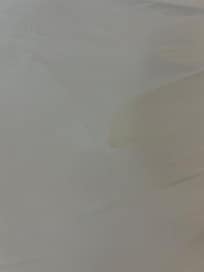 Yellow Stains on the sheet