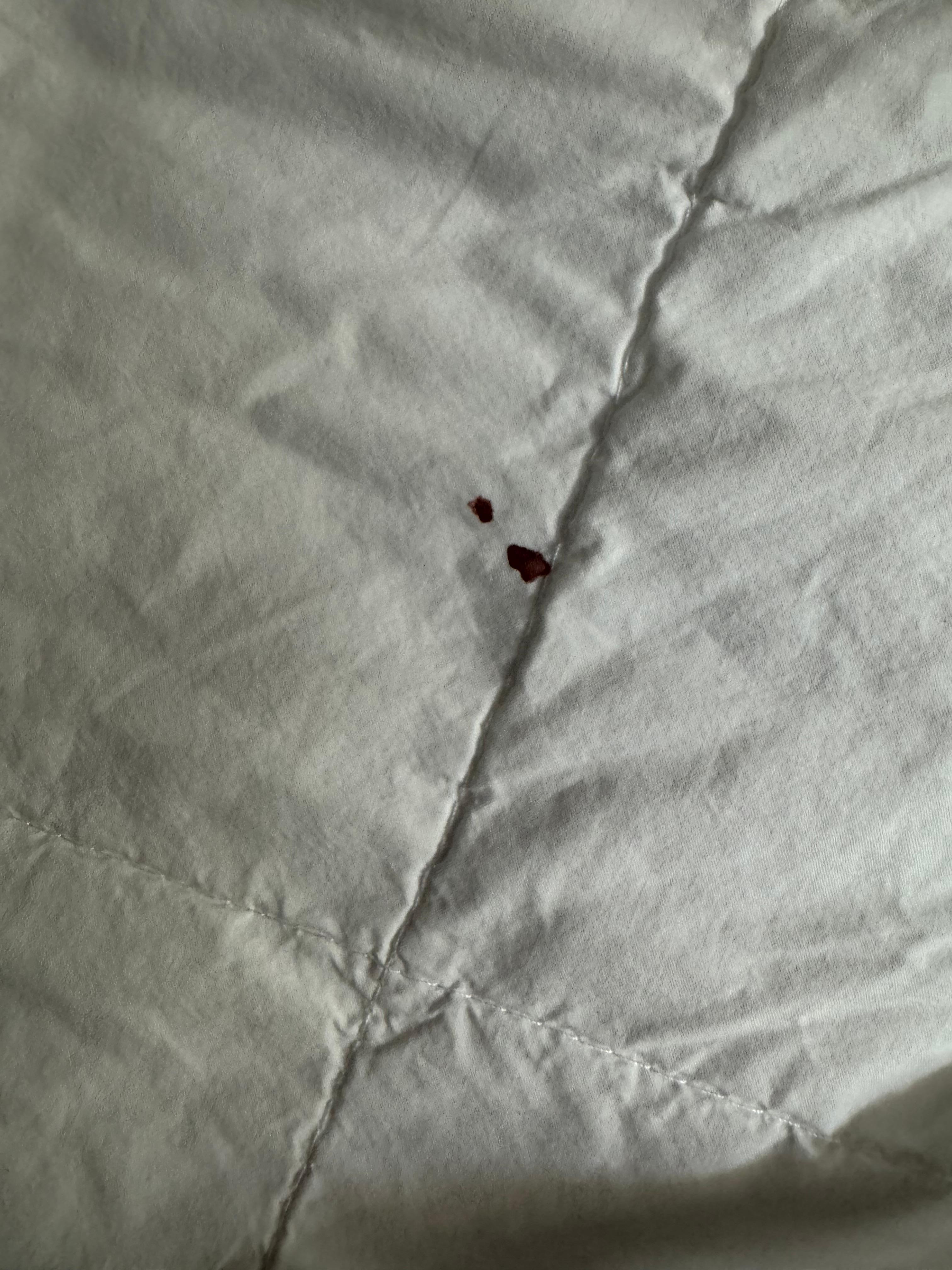 Dry blood on bedding 