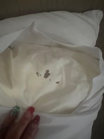 Stains on pillow and sheets