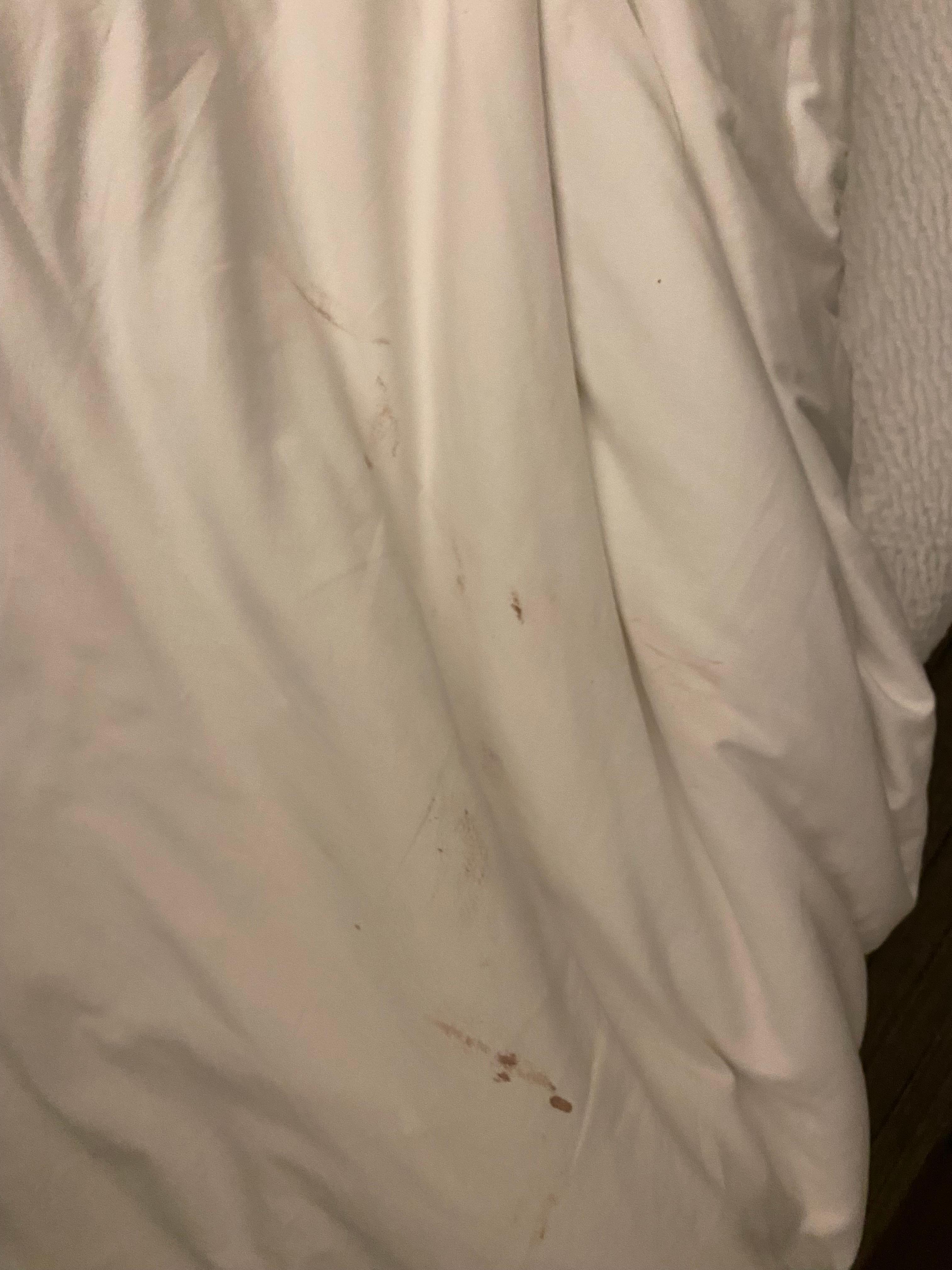 Blood stains
Pic doesn’t do justice