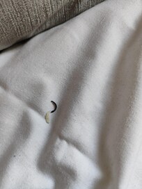 Uñas en la cama