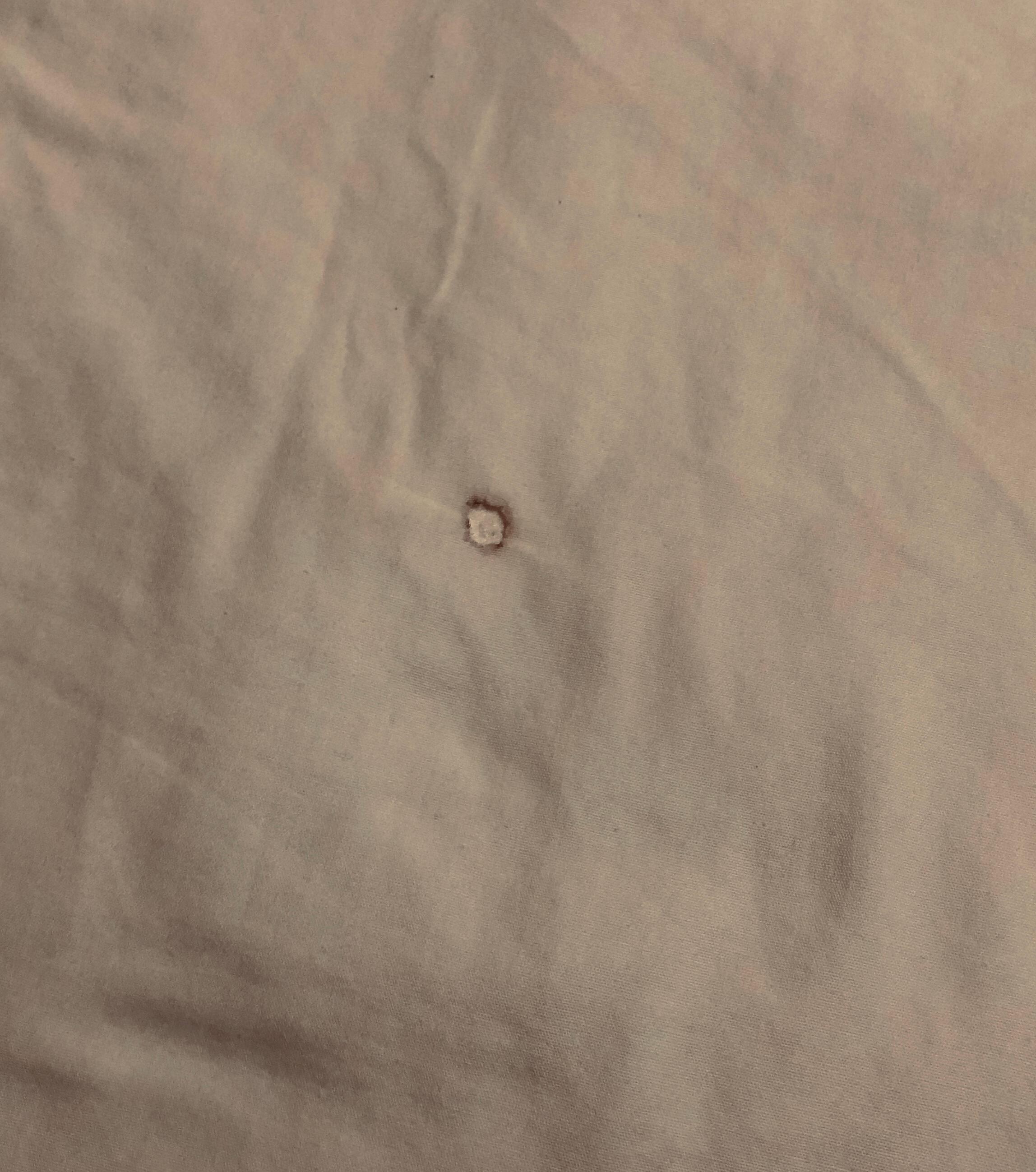 Cigarette burn hole in sheet
