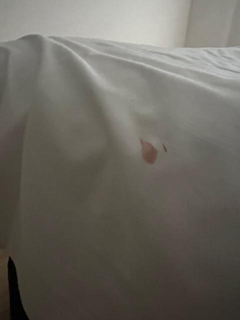 Stains on the bed