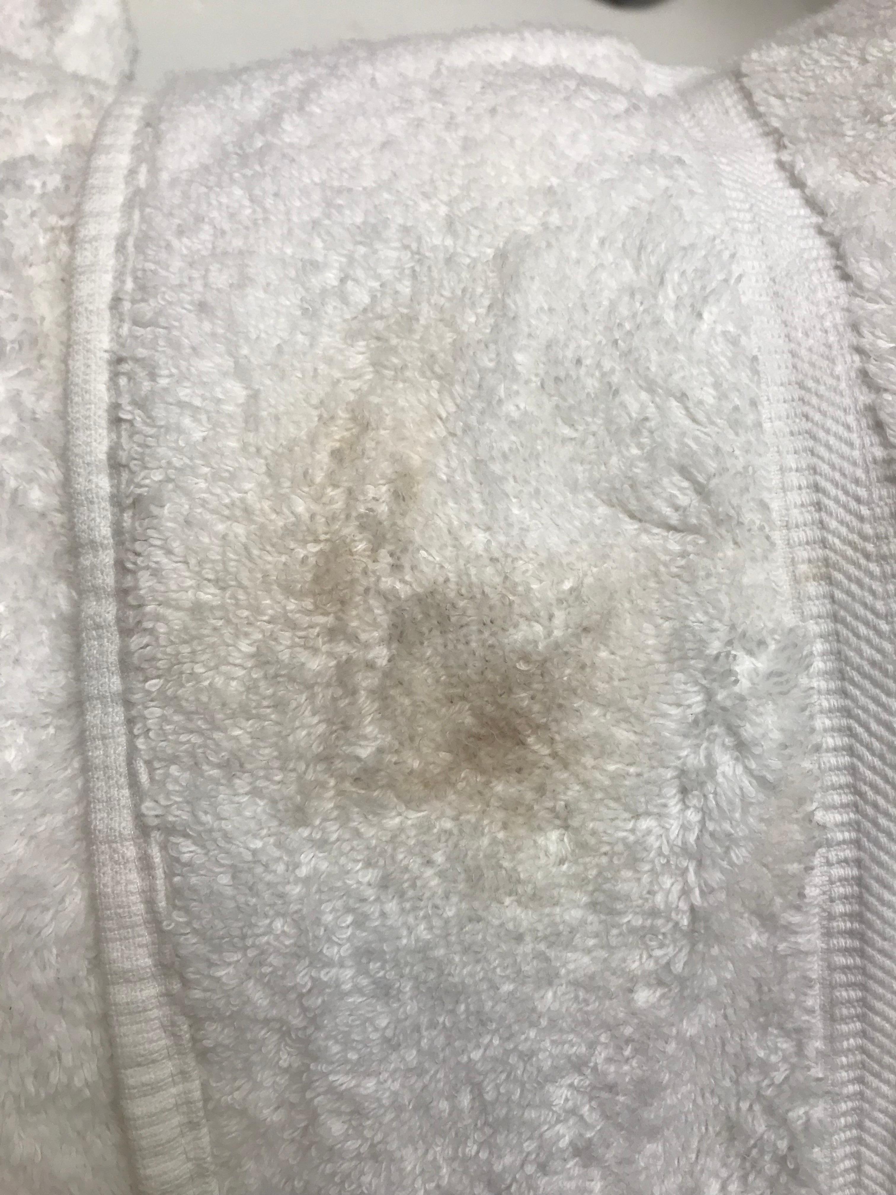 Stain on towels