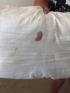BLOOD!!! on the pillow!  