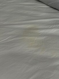 Pee mark on bed sheet