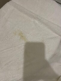 Brown (appears to be poo) with pubic hair