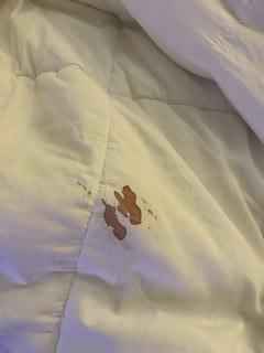 Blood stain on comforter