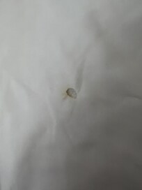 Burn hole in sheet