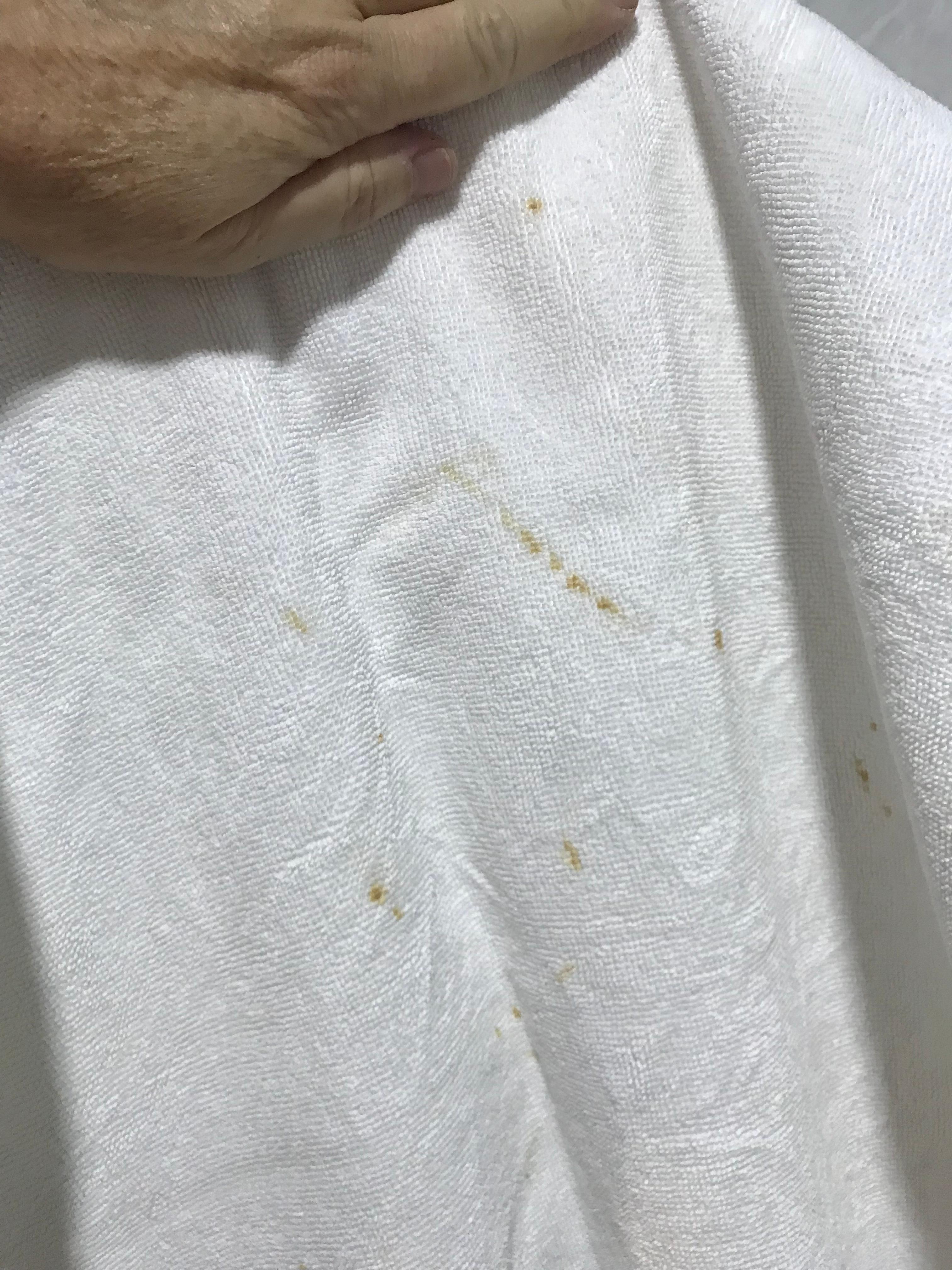 Stained/dirty towels